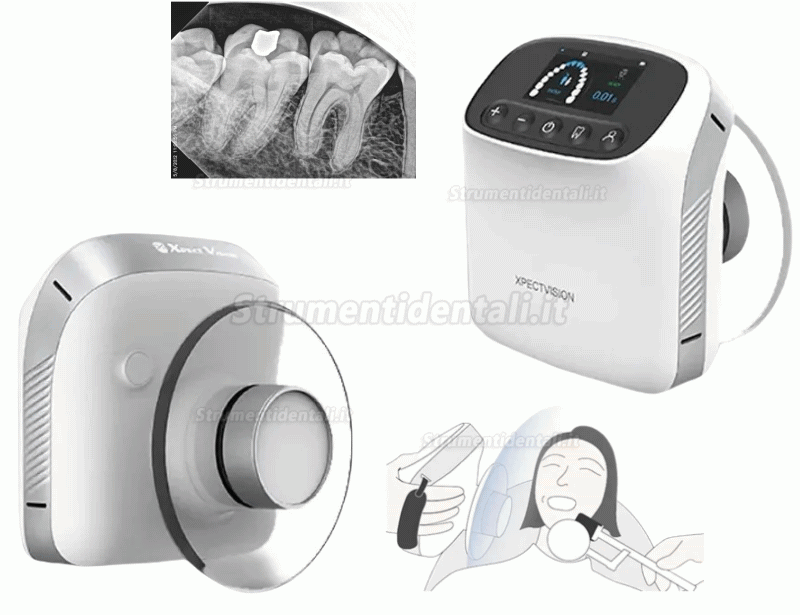 Apparecchiatura radiologica dentale portatile, Radiografico endorale portatile ad alta frequenza XVbeam2000